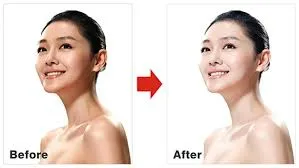 Glutathione trắng da có hiệu quả không? Giải đáp từ chuyên gia và kinh nghiệm thực tế