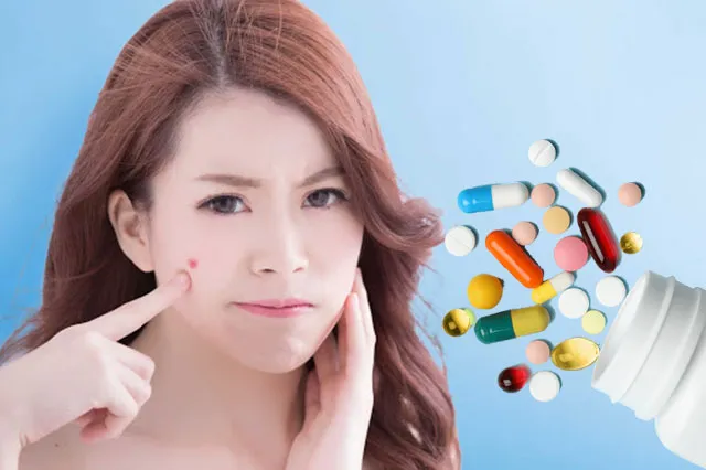 Tại sao thực phẩm chức năng lại được quan tâm trong việc trị mụn?